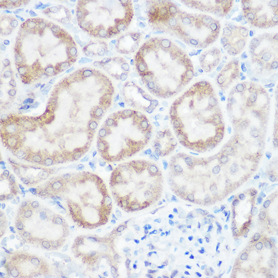 [KO Validated] NDUFB4 Rabbit polyclonal antibody
