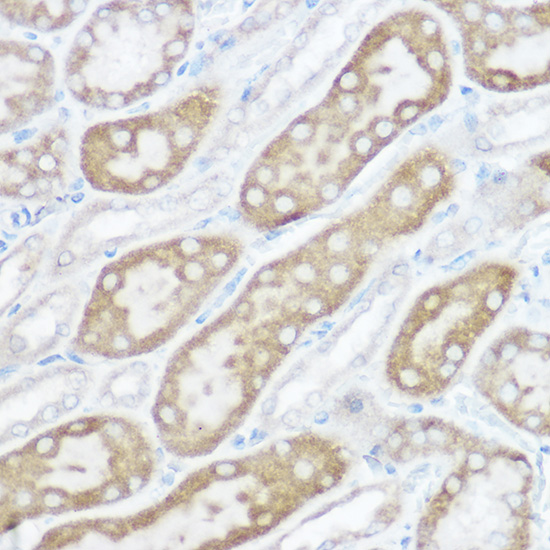 [KO Validated] NDUFB4 Rabbit polyclonal antibody