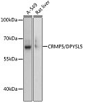 Western blot - CRMP5/DPYSL5 Rabbit pAb (A13892)