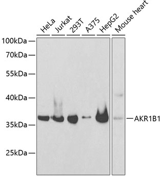 AKR1B1 Rabbit pAb