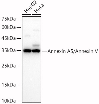 Annexin A5/Annexin V Rabbit pAb