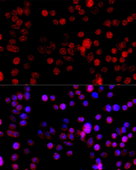 CYP1B1 Rabbit pAb