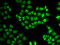 Immunofluorescence - EWSR1 Rabbit pAb (A13978)