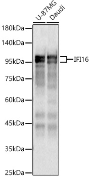 IFI16 Rabbit polyclonal antibody