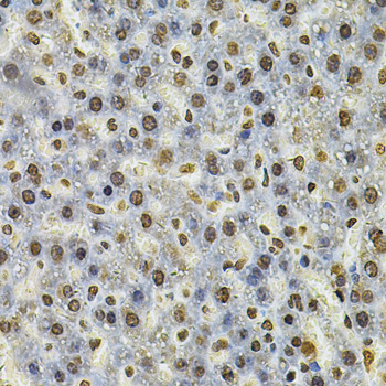 IFI16 Rabbit polyclonal antibody