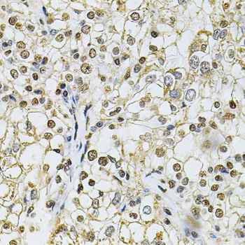 IFI16 Rabbit polyclonal antibody