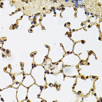 IFI16 Rabbit polyclonal antibody