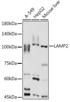 [KO Validated] LAMP2 Rabbit polyclonal antibody