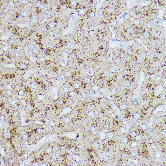 [KO Validated] LAMP2 Rabbit polyclonal antibody