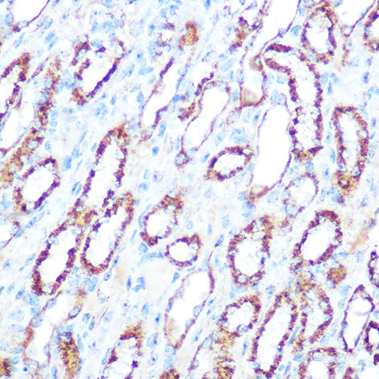 iNOS Rabbit polyclonal antibody