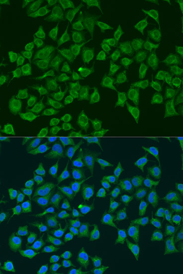 iNOS Rabbit polyclonal antibody