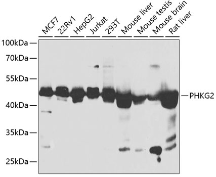 PHKG2 Rabbit pAb