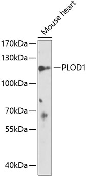 DPP6 antibody
