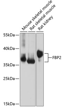 FBP2 Rabbit pAb