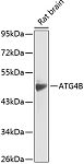 Western blot - ATG4B Rabbit pAb (A14112)