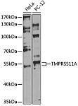 Western blot - TMPRSS11A Rabbit pAb (A14167)