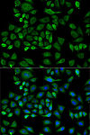 Immunofluorescence - Haptoglobin (HP) Rabbit pAb (A14186)