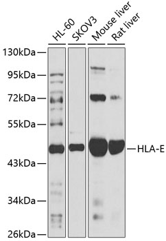 HLA-E Rabbit pAb