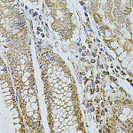 Western blot - CD62P/P-selectin Rabbit pAb (A1425)