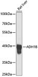 Western blot - ADH1B Rabbit pAb (A1431)