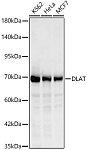 Western blot - DLAT Rabbit pAb (A14530)