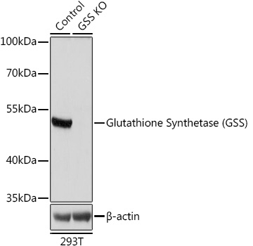 [KO Validated] Glutathione Synthetase (GSS) Rabbit polyclonal antibody
