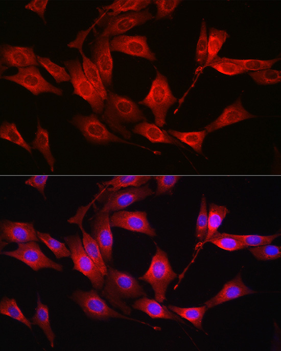 [KO Validated] Glutathione Synthetase (GSS) Rabbit polyclonal antibody