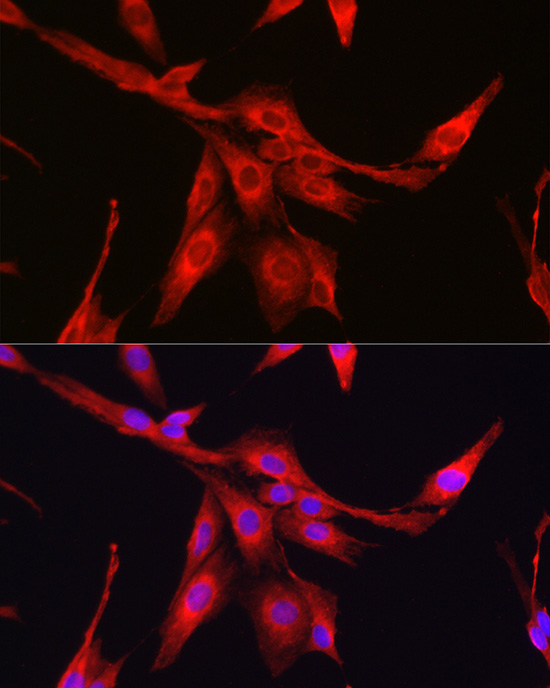 [KO Validated] Glutathione Synthetase (GSS) Rabbit polyclonal antibody