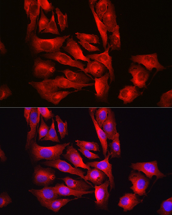 [KO Validated] Glutathione Synthetase (GSS) Rabbit polyclonal antibody