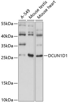 RPL18 antibody