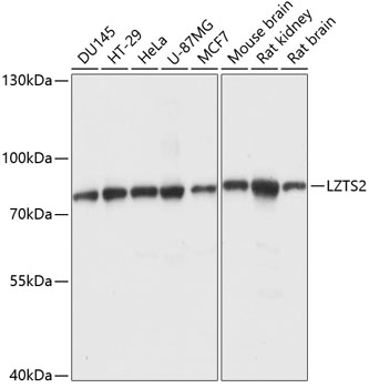 LAPTM4B antibody