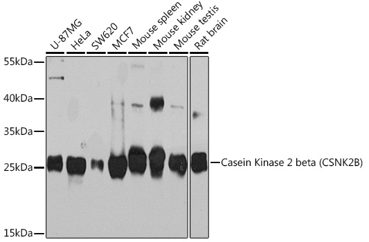 Casein Kinase 2 beta (CSNK2B) Rabbit pAb