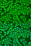 Immunofluorescence - DVL2 Rabbit pAb (A14726)