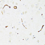 Western blot - P Glycoprotein Rabbit pAb (A14765)