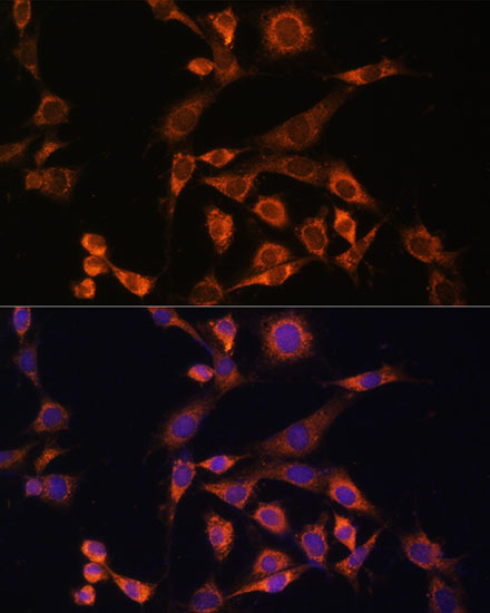 [KO Validated] MEK2 Rabbit polyclonal antibody