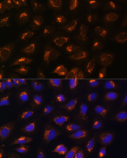 [KO Validated] MEK2 Rabbit polyclonal antibody