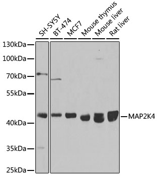 [KO Validated] MAP2K4 Rabbit polyclonal antibody