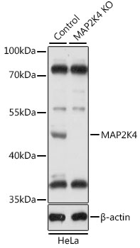 [KO Validated] MAP2K4 Rabbit polyclonal antibody