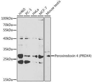 [KO Validated] Peroxiredoxin 4 (PRDX4) Rabbit polyclonal antibody