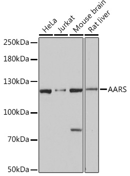 AARS Rabbit polyclonal antibody