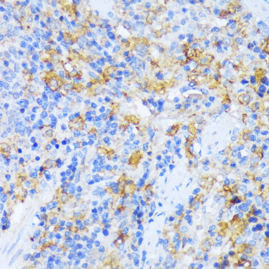 AARS Rabbit polyclonal antibody