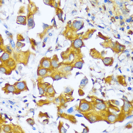 AARS Rabbit polyclonal antibody