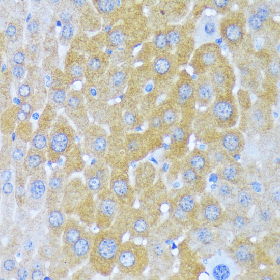 AARS Rabbit polyclonal antibody