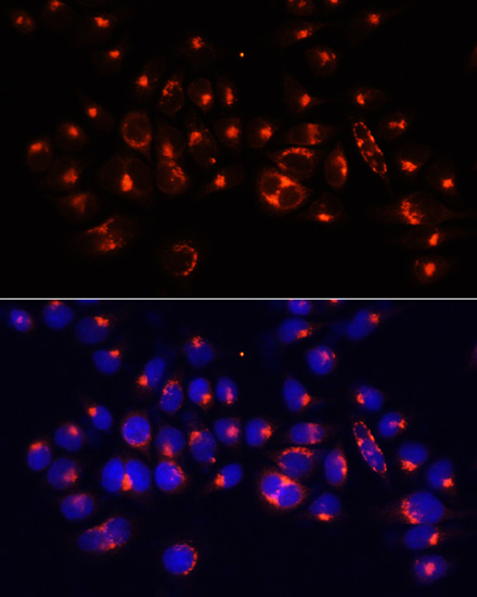 AARS Rabbit polyclonal antibody