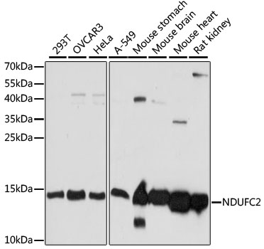 [KO Validated] NDUFC2 Rabbit polyclonal antibody