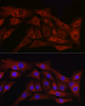 Immunofluorescence - TGF beta 1 Rabbit pAb (A15103)