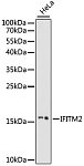 Western blot - IFITM2 Rabbit pAb (A15133)