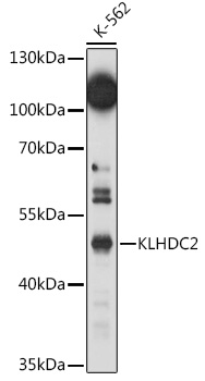KLHDC2 Rabbit polyclonal antibody
