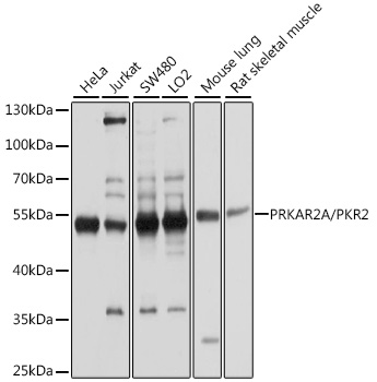 [KO Validated] PKA RIIA Alpha (PRKAR2A) Rabbit polyclonal antibody