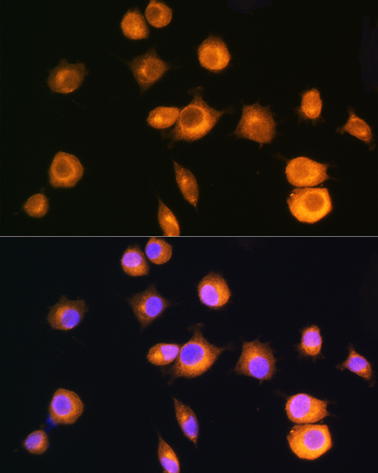 [KO Validated] PKA RIIA Alpha (PRKAR2A) Rabbit polyclonal antibody